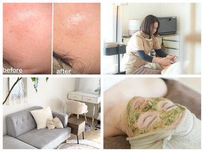 ミニョン(mignon)の写真