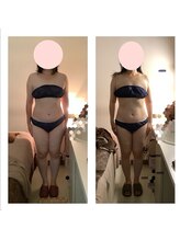 アクア エステティコ 亀有(ACQUA estetico)/40代　痩身　上半身