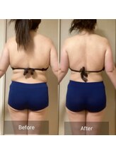 ココカラ(COCOKARA)/インディバ&アロマ痩身