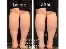 ヨサパーク 杣(YOSA PARK)/水素足浴