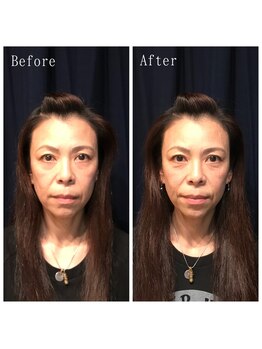 たくろう鍼灸院 豊田本院/Before＆After