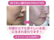 ディサイドロー(DECIDE L.A.W)