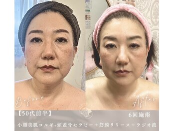 小顔美肌コルギ専門店 センティード 吉祥寺(Sentido)/