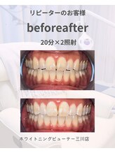 ホワイトニングビューティ 三川店/リピーターのお客様