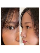 anneau 【アノー】/アンドヘルシー120本