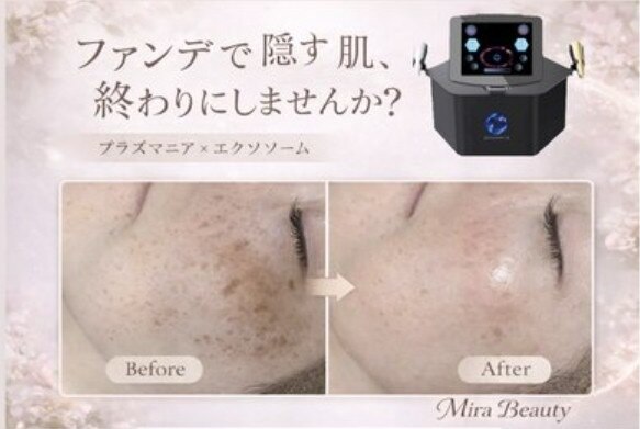 ミラビューティー(Mira Beauty)｜ホットペッパービューティー