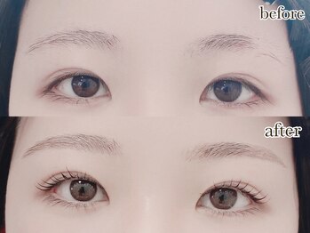 ヴィヴィッド グロウ(VIVID GLOW)の写真/《まつげ・眉の悩みを解決》逆さまつげ・薄さ・眉の悩みまで、目元全体を美しく改善