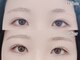ヴィヴィッド グロウ(VIVID GLOW)の写真/《まつげ・眉の悩みを解決》逆さまつげ・薄さ・眉の悩みまで、目元全体を美しく改善