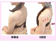 ユルポ(YuREPOS)/50代｜継続5回｜上半身華奢化