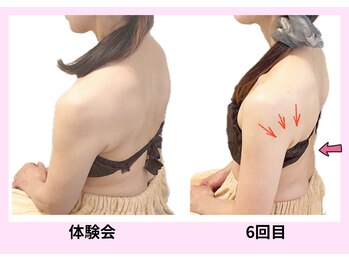 ユルポ(YuREPOS)/50代｜継続5回｜上半身華奢化