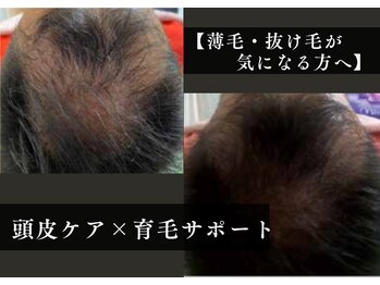 アルト(ALTO)の写真/心安らぐ空間で頭皮ケアスカルプケアを堪能。男の身だしなみを整える育毛促進サポート！