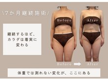 マリーズウィル(MARY's WILL)の雰囲気（姿勢もボディラインも。全身を整えて、本来の美しさへ。）