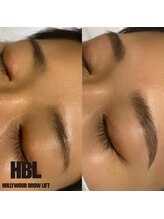 アティランス(ATTIRANCE)/【ハリウッドブロウリフト】