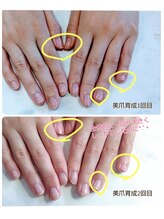 ノーブルフルール(Noble fleur)/ハンド・スペシャルネイルケア