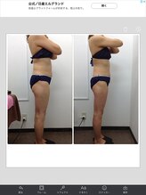 健康痩身研究所 名和店/ビフォーアフター