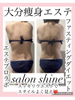 サロンシャイン(Salon Shine)/腸活ダイエット４８時間