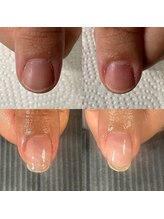 カンパニュラ(Campanula)/爪の形がコンプレックスでした！