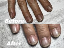 結(Yui)/自爪育成 Before→After