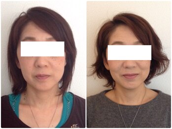 美容整体ウェリナ あま甚目寺院/小顔矯正/骨盤矯正/美脚サロン