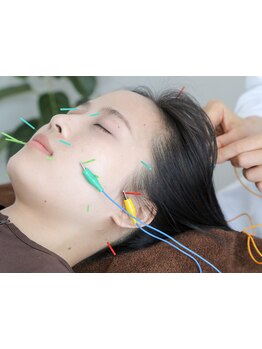 小顔になりたい