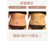 チャム(cham)の雰囲気（冷えむくみケアと脂肪燃焼で健康的なボディに♪お試し体験受付中）