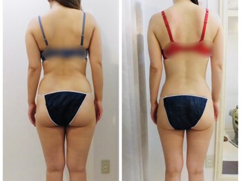 アイディエム 新宿店(IDM)/モニター毎月15名募集