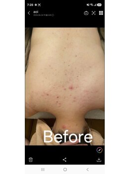 サロン ド シェ レステ(Salon de Chez reste)/