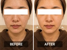 ステラ グランデ 福岡博多の雰囲気（小顔Wコルギでフェイスライン/左右差/むくみ/たるみ/スッキリ☆）