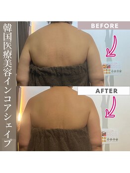 リラクゼーションサロン ラキ(laki)/インコアシェイプ
