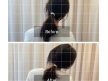 ナオル整体 札幌院(NAORU整体)/札幌円山/整体/首痛