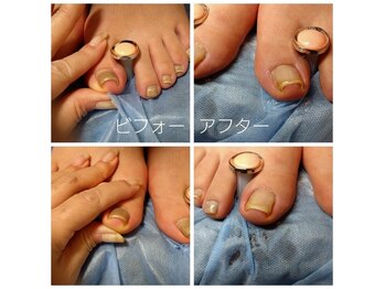 ジェネシス(GENESIS)