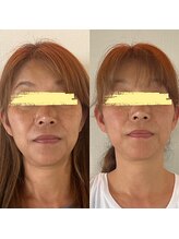 美健家/before⇒after