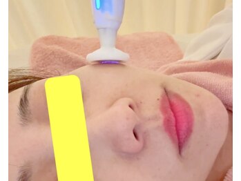 エレガンテ(ELEGANTE)/オゾンプラズマシャワー