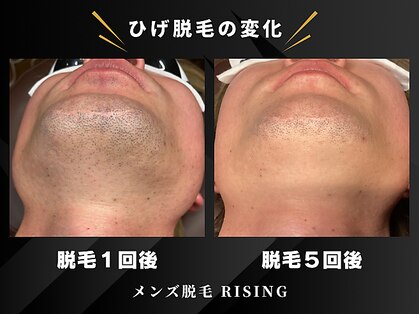 ライジング(RISING)の写真