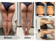 エミット(emit)/脂肪燃焼＆分解