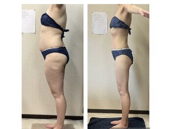 美ボディラボ(美Body Labo)/ハーブ