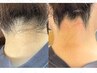 地域独占!美形うなじデザインW脱毛★ ¥3500【保湿仕上げ】シュガーリング脱毛