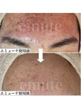 リュミエール デスポワール(Lumiere d'espoir)/ホームケア