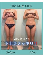 スリムライク 鳥取店(The SLIM LIKE)/痩身ビフォーアフター