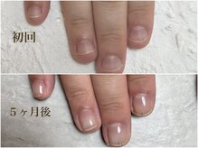 ビビネイル(vivi.NAIL)/自爪育成