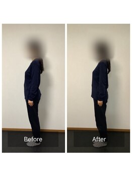 ロコモ(Locomo)/お客様のbefore after