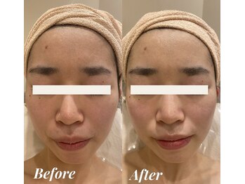 シェリール(Cherir)/タラソトリートメント