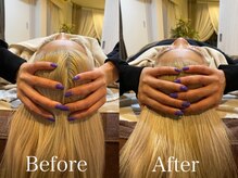 リノア(Linoa)/Linoa式頭蓋骨矯正