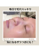 香翠/気になるざらつき 拡がった毛穴!