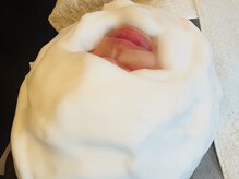 リフレ(Refre)/メンズも顔脱毛が人気^_^