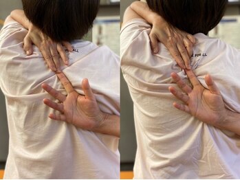 おき整骨院/首肩こりでお悩みの方にも