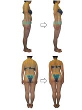 ハナン(Hanan)/ナノカレントで全身骨格矯正！