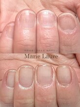 マリーロール 淀屋橋本店(Marie Laure)/自爪育成/深爪矯正/ネイルケア