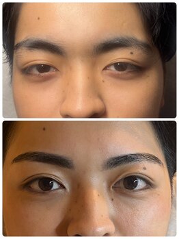 スリーピース(3Peace)/Before/After