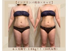 オキシー グレイス 黒崎店(OXY Grace)/インドリンパ痩身×キャビ